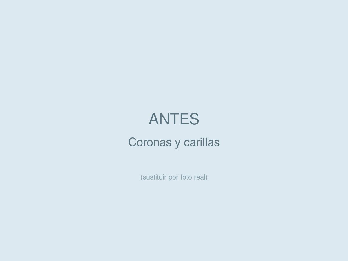 Coronas y Carillas, antes