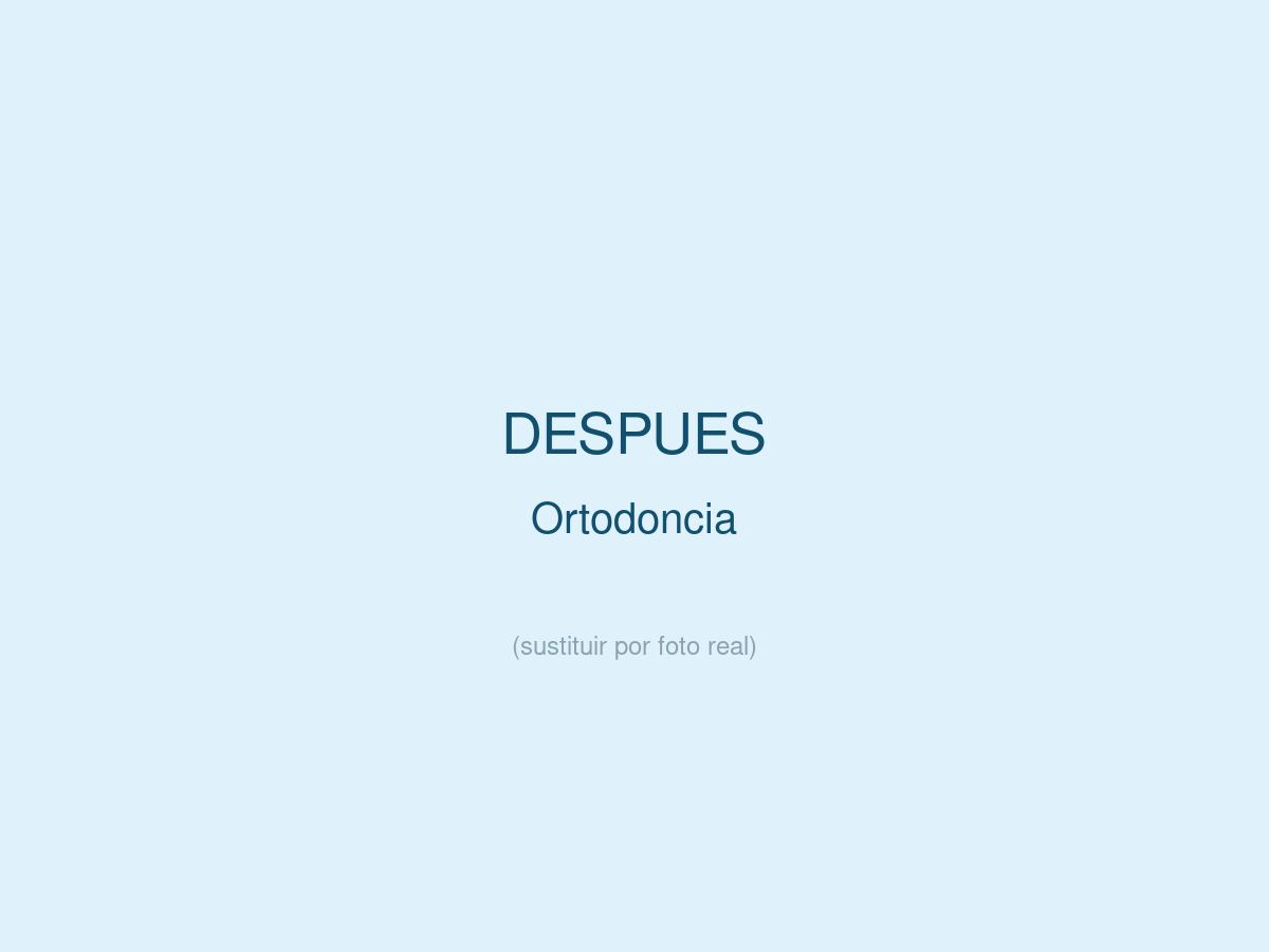 Ortodoncia, despu&eacute;s