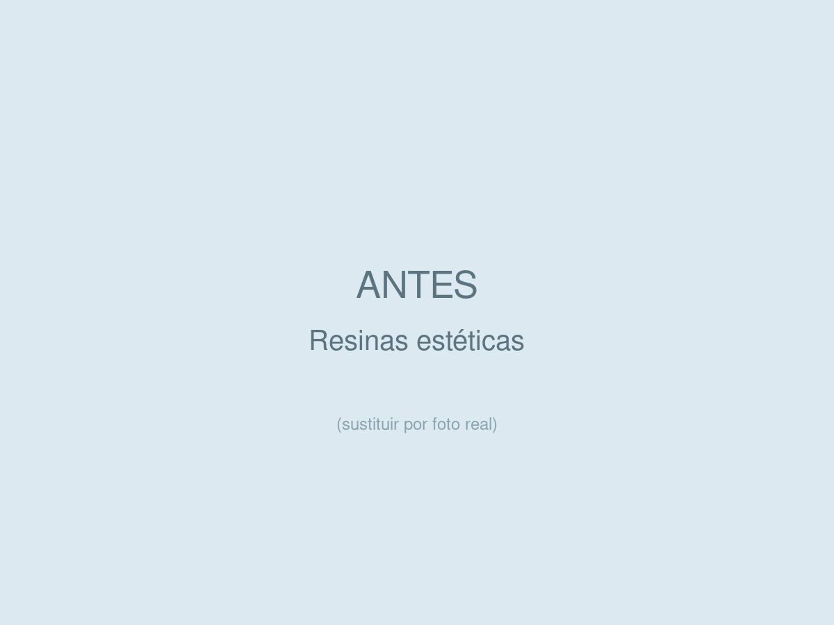 Resinas Est&eacute;ticas, antes